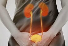 أسباب التبول المتكرر ليلا لدى النساء؟