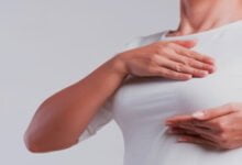 علاج ارتفاع هرمون الحليب