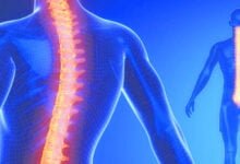 ما هي أسباب انحناء العمود الفقري؟