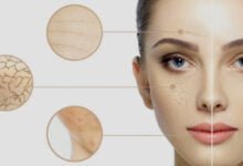 كم مدة الاستحمام المثالية لصحة البشرة؟.. أطباء ألمان يجيبون