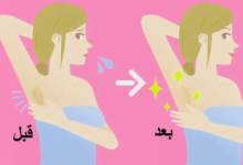 وصفات لتفتيح المناطق الحساسة