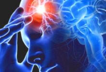 خطوات للوقاية من السكتة الدماغية