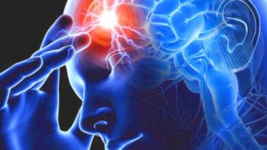 خطوات للوقاية من السكتة الدماغية