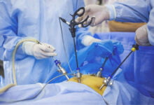 مخاطر جراحات الوزن؟