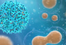 معدلات إصابة الدول العربية بسرطانات الغدد الليمفاوية والمثانة والثدي والكبد تظهر أرقاماً مرتفعة