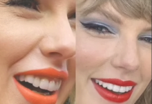 أسنان تايلور قبل الإجراء الأخير