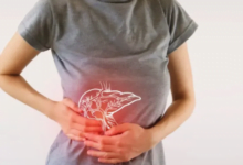 ‫ما هي متلازمة مولينغراخت؟