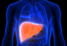 الولايات المتحدة توافق على أول دواء لعلاج الشكل الحاد من مرض الكبد الدهني