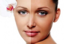 أسباب اسمرار الوجه