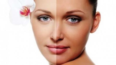 أسباب اسمرار الوجه