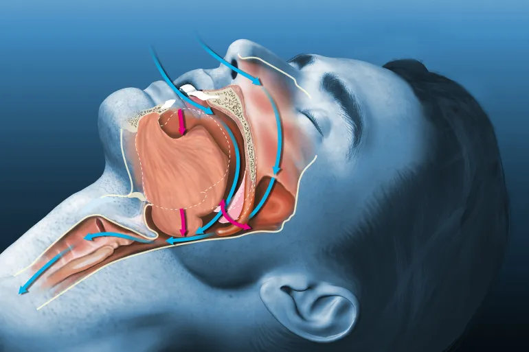 الكرياتين يحسّن أداء الدماغ في فترات الحرمان من النوم