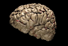 عملية اتخاذ القرار في الدماغ: كيف يحدد أي الذكريات يجب الاحتفاظ بها وأيها يجب التخلص منها؟