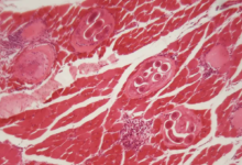 كباب لحم الدب يتسبب بإصابة عائلة أميركية بديدان دماغية موجودة في لحوم الخنزير