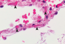 تطوير روبوتات هجينة بيولوجيا لعلاج السرطان