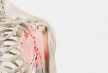 أسباب تورم الغدد الليمفاوية تحت الإبط؟