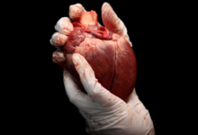 تقنية جديدة قد تتيح المزيد من الأعضاء البشرية للزراعة