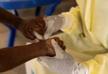 الكونغو الديمقراطية تطلق مبادرة بقيمة 45 مليون يورو لمكافحة جدري القرود وسط تحديات انتشار المرض وتأخير اللقاحات