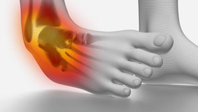 إصابات الكاحل الأعراض والعلاج
