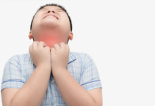 أعراض وأسباب التهاب المريء لدى الأطفال وطرق العلاج الفعّالة