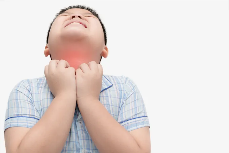 أعراض وأسباب التهاب المريء لدى الأطفال وطرق العلاج الفعّالة