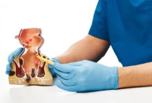 دراسة يابانية تكشف دور مكونات الطعام المحفزة للمناعة في منع نمو الأورام بالأمعاء الدقيقة