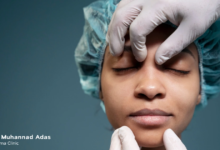 أكثر 5 أسئلة شيوعًا عن عملية شد الوجه الجراحي 