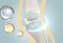 أنواع سرطان العظام وأعراضه وطرق علاجه